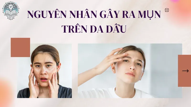 chăm sóc da dầu mụn  1