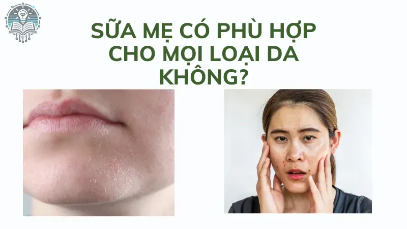 làm đẹp bằng sữa mẹ 4