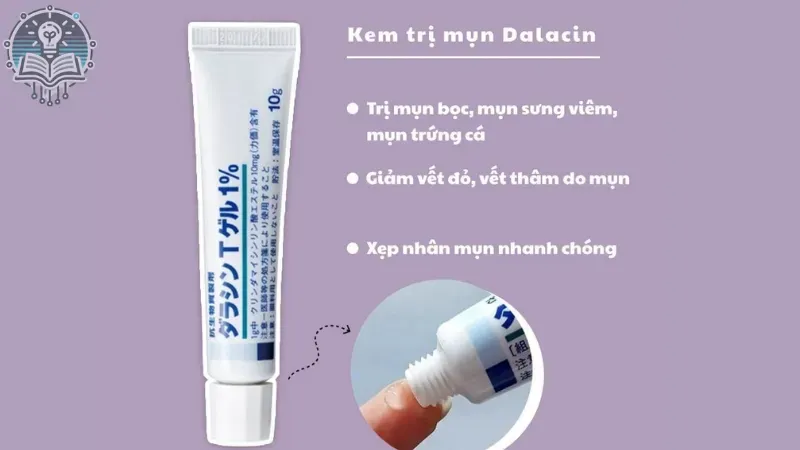 5 loại thuốc trị mụn bác sĩ khuyên dùng 4