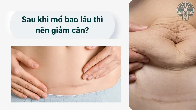 cách giảm cân sau sinh mổ 3