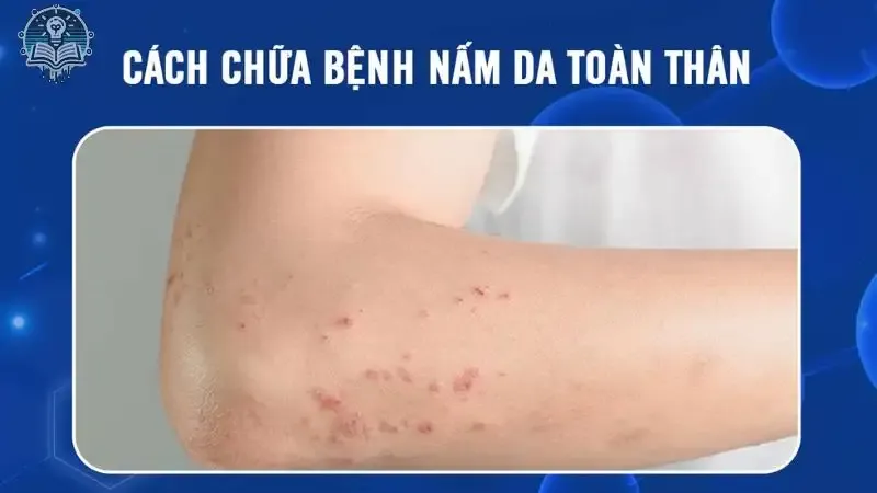 tác hại do nấm da  2