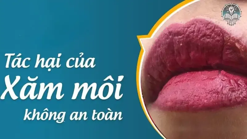 tác hại khi xăm môi 8