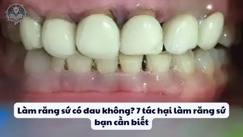 Làm răng sứ có đau không? 7 tác hại làm răng sứ bạn cần biết