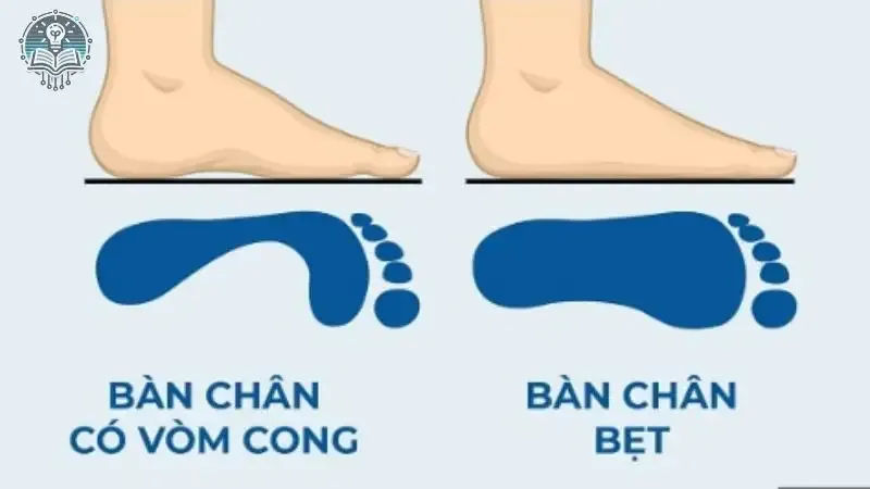 tác hại bàn chân bẹt 1