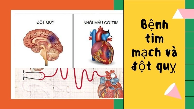 “Đánh thức” hàng loạt bệnh tim mạch và đột quỵ 