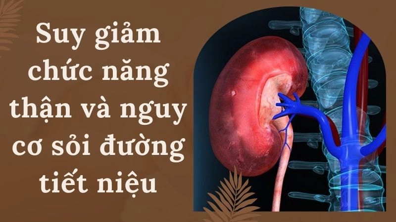 Suy giảm chức năng thận và nguy cơ sỏi đường tiết niệu