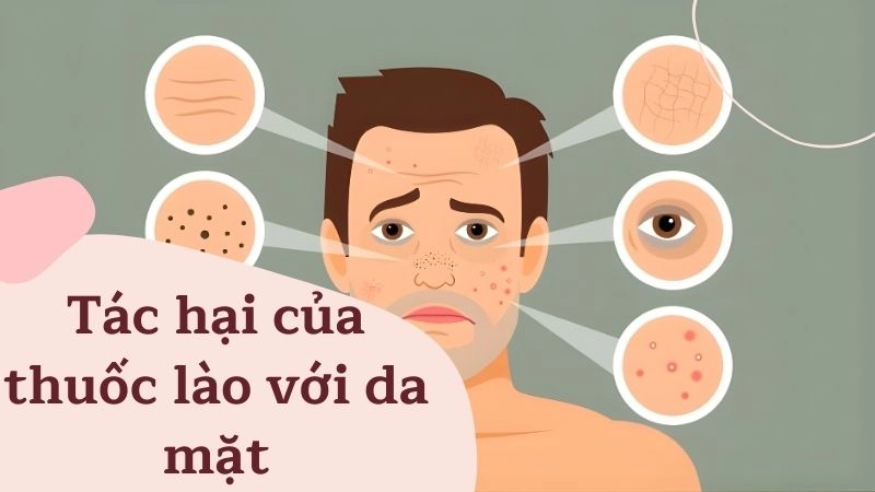 Thuốc lào đẩy nhanh quá trình lão hóa da mặt