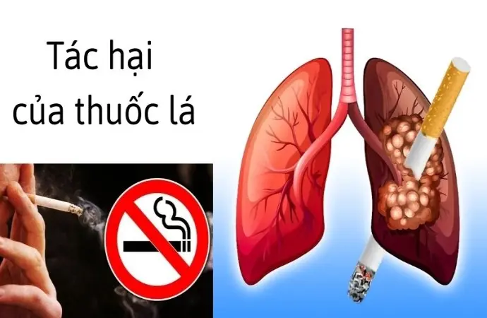 Tác hại của thuốc lá khiến bạn phải suy ngẫm về sức khỏe