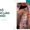 Thuốc lào và những trải nghiệm thực tế về cái bẫy sức khỏe đó