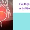 Nhịn tiểu và những biến chứng nguy hiểm tôi đã trải qua
