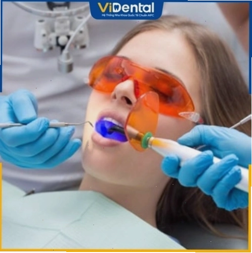 Công nghệ trám răng Laser Tech AN TOÀN - KHÔNG BIẾN CHỨNG