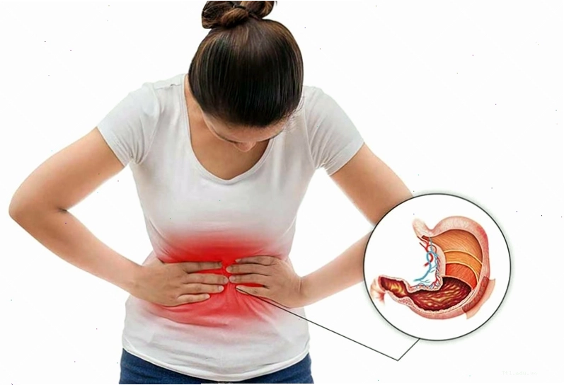 Curcumin trong nghệ đen giúp giảm viêm loét dạ dày