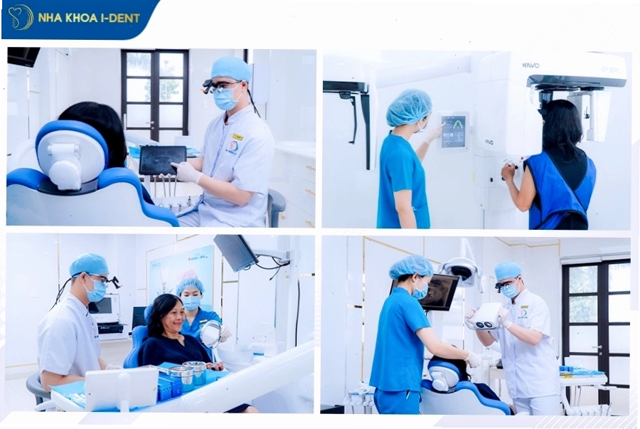 Hình ảnh minh họa trụ implant bị đào thải khỏi xương hàm
