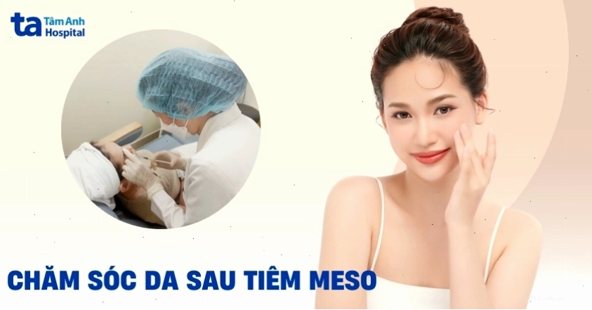 Hướng dẫn chăm sóc da sau tiêm meso