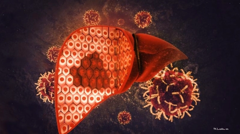 Kombucha có thể gây độc cho gan