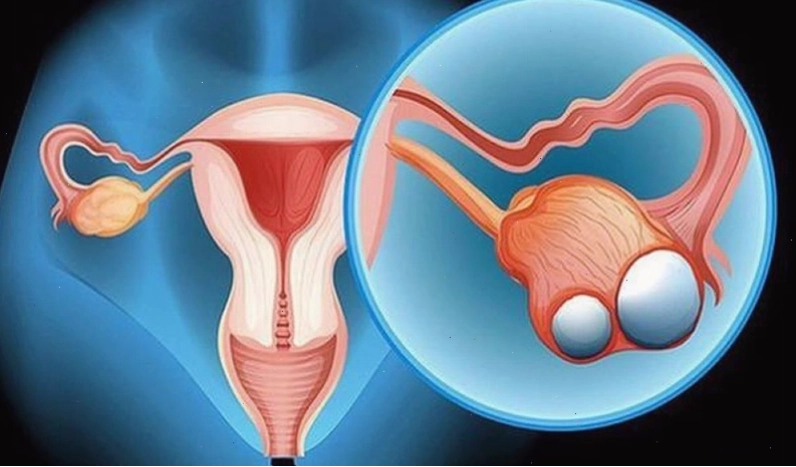 Lời khuyên về cách sử dụng sữa đậu nành an toàn cho nữ giới