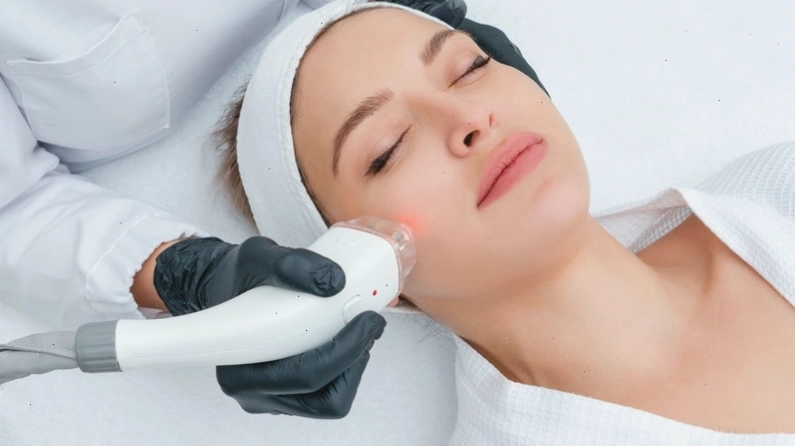 Lưu ý khi điều trị nám da bằng laser