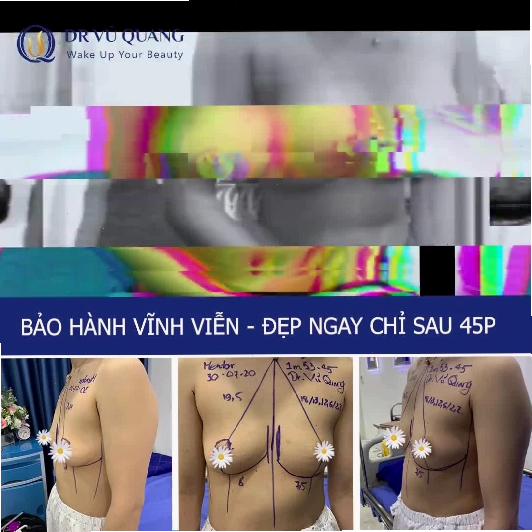 Nâng cấp vòng một giúp tự tin hơn khi diện trang phục