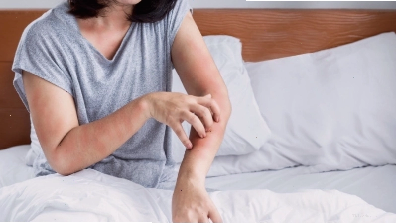 Phản ứng dị ứng do rau diếp cá