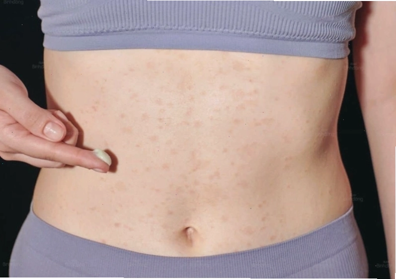 Tác hại của máy rung bụng đối với hệ tim mạch