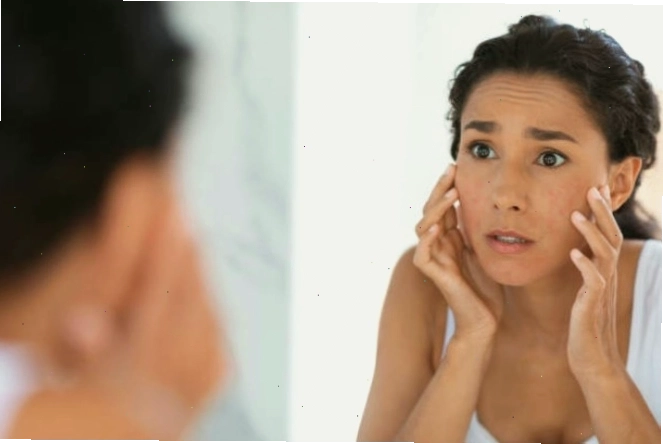 Tác hại của nha đam với da mặt: tình trạng kích ứng da