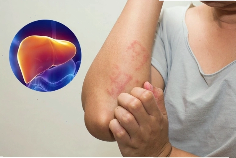 Tác hại của tỏi đen ảnh hưởng đến gan gây ra dấu hiệu buồn nôn