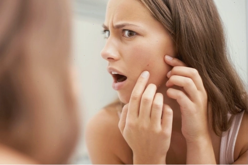 Thức khuya dễ gây ra các vấn đề về da như mụn trứng cá