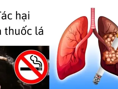 Tác hại của thuốc lá khiến bạn phải suy ngẫm về sức khỏe