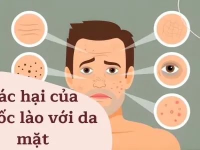 Tác hại của thuốc lào với da mặt và cảnh báo da liễu