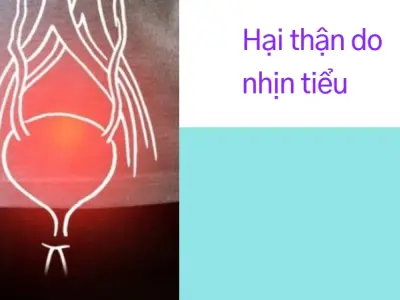 Nhịn tiểu và những biến chứng nguy hiểm tôi đã trải qua