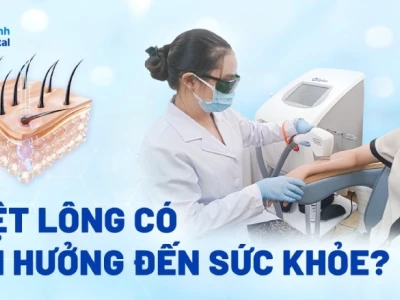 Tác hại của triệt lông vĩnh viễn những điều bạn cần biết