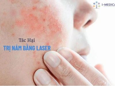 Tác hại của việc trị nám bằng laser và những lưu ý quan trọng